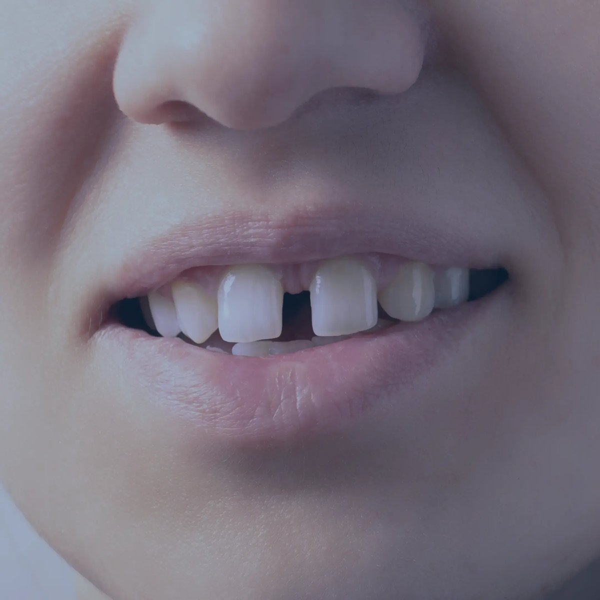 gap